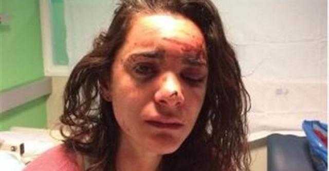 فتاة شجاعة تنشر صور وجهها ملطخا بالدماء بعد ضربها واغتصابها