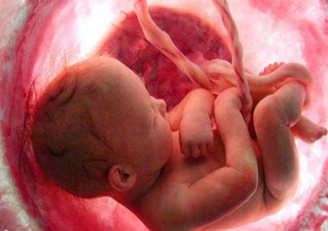 ما هي علامات وفاة الجنين قبل ولادته؟