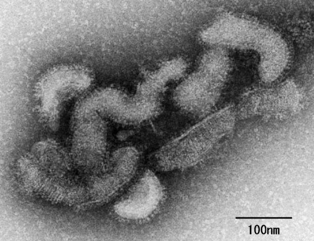 بعد الكورونا .. اليابان تسجل أول حالة وفاة بـ”فيروس أوز”